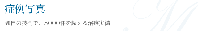症例紹介／独自の技術で、5000件を超える治療実績