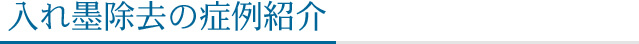 入れ墨除去の症例紹介