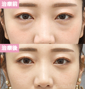 症例296 モニター 25歳女性