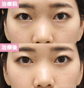 症例299 モニター 29歳女性