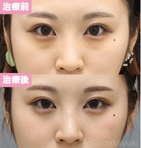 症例302 モニター 21歳女性