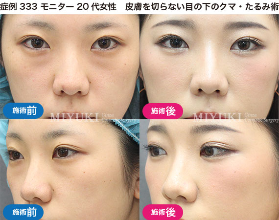 クマ治療の症例写真・No296