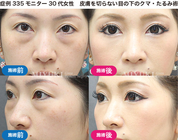 クマ治療の症例写真・No255