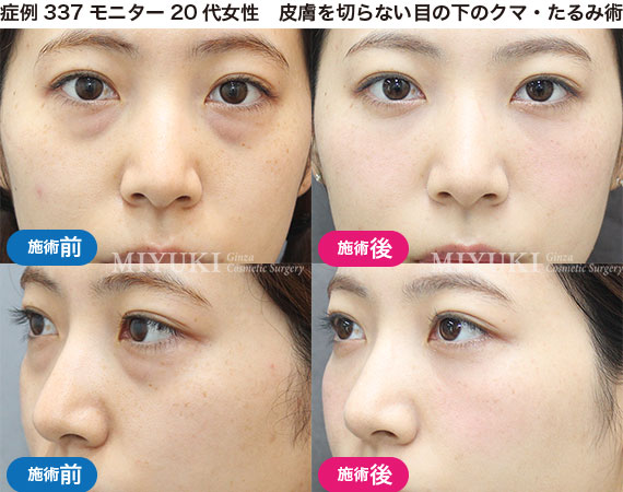 クマ治療の症例写真・No299