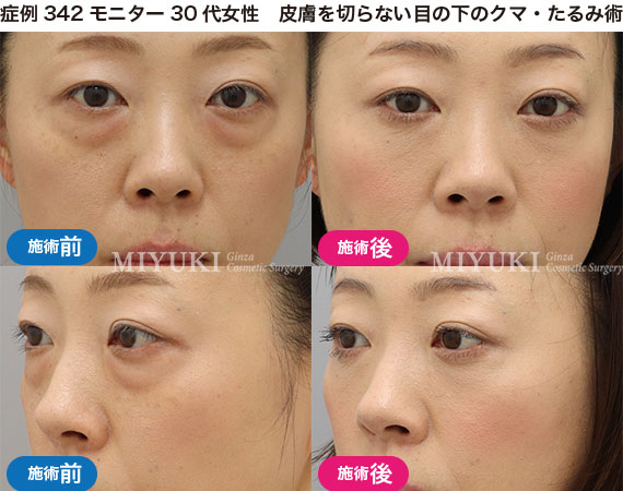 クマ治療の症例写真・No298