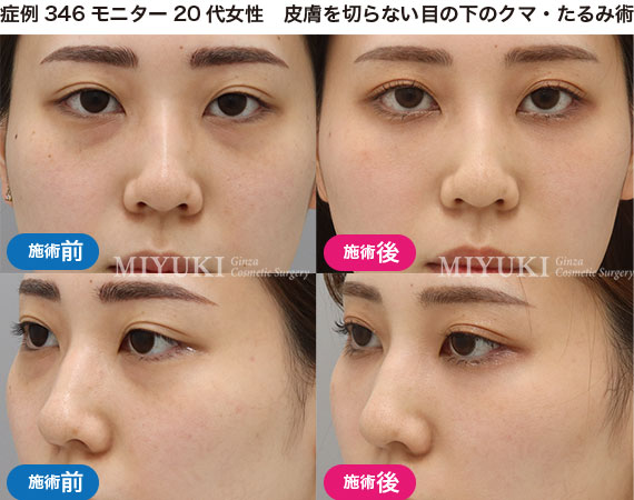 クマ治療の症例写真・No260