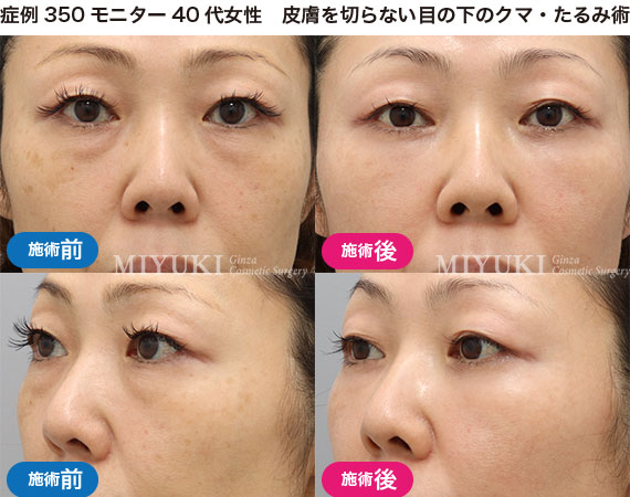 クマ治療の症例写真・No315