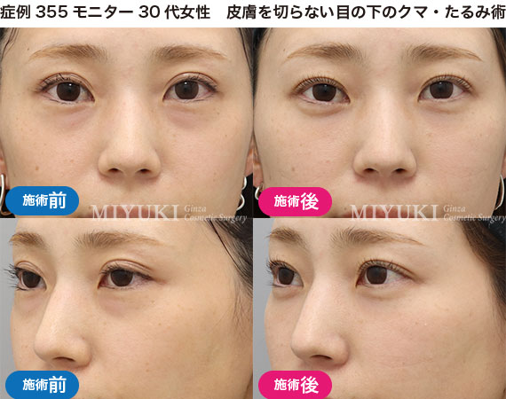 クマ治療の症例写真・No262