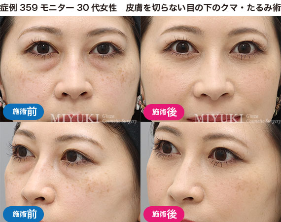 クマ治療の症例写真・No244