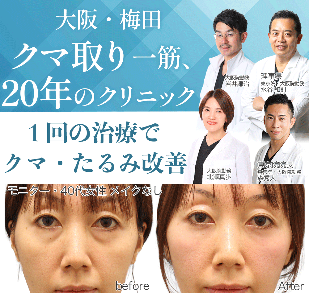 目の下のクマやたるみが気になるあなたへ