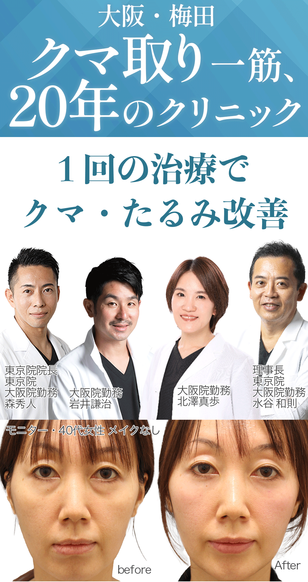 目の下のクマやたるみが気になるあなたへ